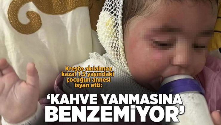 Kreşte 1,5 yaşındaki çocuk kahve ile yandı! Anne isyan etti