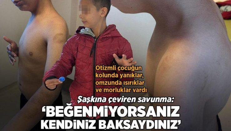 Otizmli çocuğa bakımevinde şiddet iddiası! ‘Beğenmiyorsanız kendiniz baksaydınız’